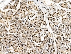 Invitrogen SON Polyclonal Antibody 100 &mu;L; Unconjugated:Antibodies,