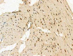Invitrogen SON Polyclonal Antibody 100 &mu;L; Unconjugated:Antibodies,