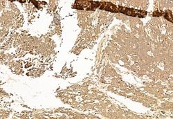 Invitrogen SP1 Polyclonal Antibody 100 &mu;L; Unconjugated:Antikörper