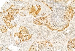 Invitrogen SP1 Polyclonal Antibody 100 &mu;L; Unconjugated:Antikörper