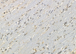 Invitrogen SP6 Polyclonal Antibody 100 μL; Unconjugated:Antibodies,