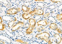 Invitrogen SPG11 Polyclonal Antibody 100 &mu;L; Unconjugated:Antibodies,