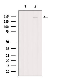 Invitrogen SPG11 Polyclonal Antibody 100 &mu;L; Unconjugated:Antibodies,