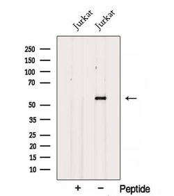 Invitrogen SPTLC1 Polyclonal Antibody 100 &mu;L | Buy Online | Invitrogen&trade; | Fisher Scientific