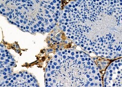 Invitrogen SRD5A2 Polyclonal Antibody 100 &mu;L; Unconjugated:Antibodies,