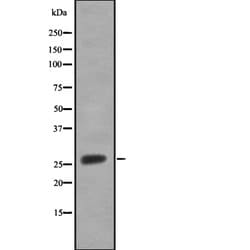 Invitrogen SRD5A2 Polyclonal Antibody 100 &mu;L; Unconjugated:Antibodies,