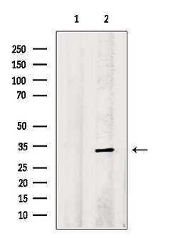 Invitrogen STARD7 Polyclonal Antibody 100 &mu;L | Buy Online | Invitrogen&trade; | Fisher Scientific