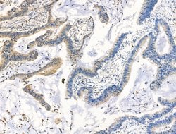 Invitrogen STATH Polyclonal Antibody 100 &mu;L; Unconjugated:Antibodies,