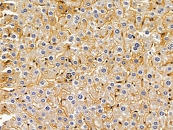 STEAP3 Polyclonal Antibody:Antibodies, Polyclonal