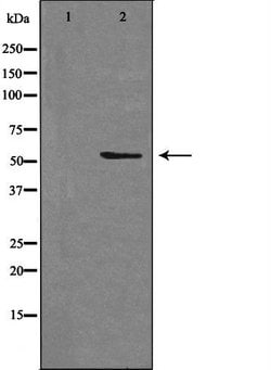 Invitrogen STEAP3 Polyclonal Antibody 100 &mu;L; Unconjugated:Antibodies,