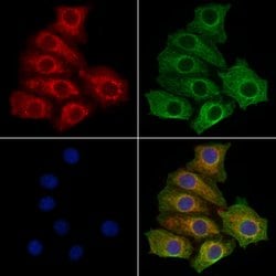 Invitrogen STS Polyclonal Antibody 100 μL; Unconjugated:Antibodies,