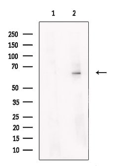 Invitrogen STS Polyclonal Antibody 100 μL; Unconjugated:Antibodies,