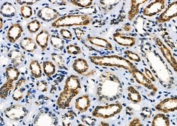 MST2 Polyclonal Antibody:Antibodies, Polyclonal