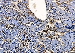 MST2 Polyclonal Antibody:Antibodies, Polyclonal