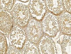 Invitrogen STRA8 Polyclonal Antibody 100 &mu;L; Unconjugated:Antibodies,