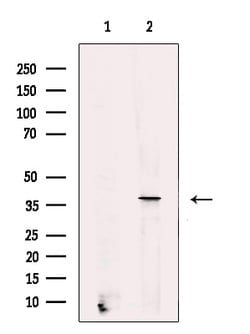 Invitrogen STRA8 Polyclonal Antibody 100 &mu;L; Unconjugated:Antibodies,