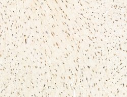 Invitrogen STS1 Polyclonal Antibody 100 &mu;L; Unconjugated:Antibodies,