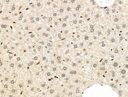 Invitrogen STS1 Polyclonal Antibody 100 &mu;L; Unconjugated:Antibodies,