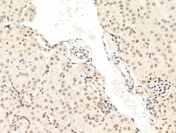 Invitrogen STS1 Polyclonal Antibody 100 &mu;L; Unconjugated:Antibodies,