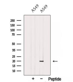 Invitrogen PC4 Polyclonal Antibody 100 &mu;L; Unconjugated:Antibodies,