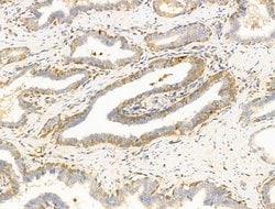 Invitrogen SUCLG1 Polyclonal Antibody 100 &mu;L; Unconjugated:Antibodies,