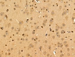 Invitrogen SUCLG1 Polyclonal Antibody 100 &mu;L; Unconjugated:Antibodies,