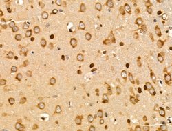 Invitrogen SUCLG1 Polyclonal Antibody 100 &mu;L; Unconjugated:Antibodies,