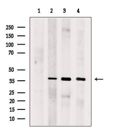 Invitrogen SUCLG1 Polyclonal Antibody 100 &mu;L; Unconjugated:Antibodies,