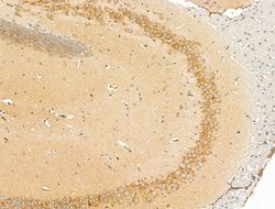 Invitrogen SULF1 Polyclonal Antibody 100 &mu;L; Unconjugated:Antibodies,