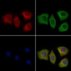Invitrogen SFTPA2 Polyclonal Antibody 100 &mu;L; Unconjugated:Antibodies,
