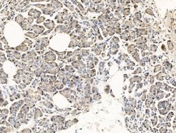 Invitrogen SFTPA2 Polyclonal Antibody 100 &mu;L; Unconjugated:Antibodies,