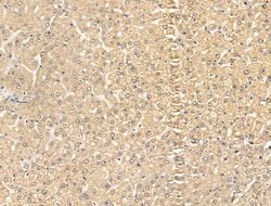 Invitrogen SFTPA2 Polyclonal Antibody 100 &mu;L; Unconjugated:Antibodies,