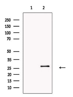 Invitrogen SFTPA2 Polyclonal Antibody 100 &mu;L; Unconjugated:Antibodies,