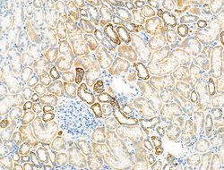 Invitrogen SV2A Polyclonal Antibody 100 &mu;L; Unconjugated:Antibodies,