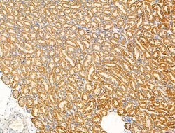 Invitrogen SV2A Polyclonal Antibody 100 &mu;L; Unconjugated:Antibodies,