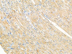 Invitrogen SV2A Polyclonal Antibody 100 &mu;L; Unconjugated:Antibodies,