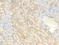 Invitrogen SV2A Polyclonal Antibody 100 &mu;L; Unconjugated:Antibodies,