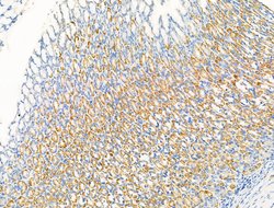 Invitrogen SV2A Polyclonal Antibody 100 &mu;L; Unconjugated:Antibodies,