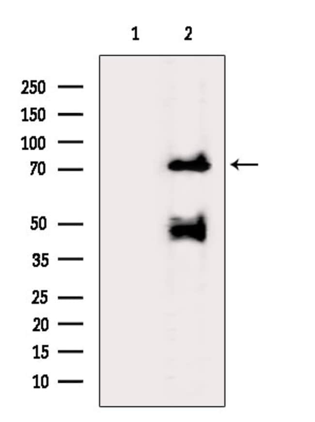 Invitrogen Synapsin 2 Polyclonal Antibody 100 μL; Unconjugated ...