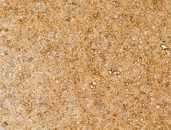 Invitrogen Synaptotagmin 5 Polyclonal Antibody 100 &mu;L; Unconjugated:Antibodies,