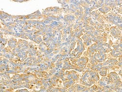 Invitrogen Syntaxin 2 Polyclonal Antibody 100 &mu;L; Unconjugated:Antibodies,