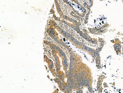 Syntrophin alpha-1 Polyclonal Antibody, Invitrogen 100 &mu;L; Unconjugated:Antibodies,
