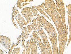 Syntrophin alpha-1 Polyclonal Antibody, Invitrogen 100 &mu;L; Unconjugated:Antibodies,