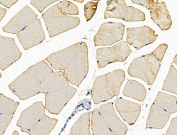 Syntrophin alpha-1 Polyclonal Antibody, Invitrogen 100 &mu;L; Unconjugated:Antibodies,