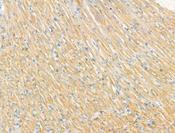 Syntrophin alpha-1 Polyclonal Antibody, Invitrogen 100 &mu;L; Unconjugated:Antibodies,