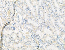 Syntrophin alpha-1 Polyclonal Antibody, Invitrogen 100 &mu;L; Unconjugated:Antibodies,