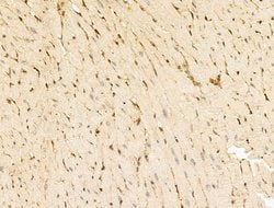 Invitrogen TACC2 Polyclonal Antibody 100 &mu;L; Unconjugated:Antikörper