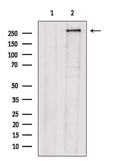 Invitrogen TACC2 Polyclonal Antibody 100 &mu;L; Unconjugated:Antikörper