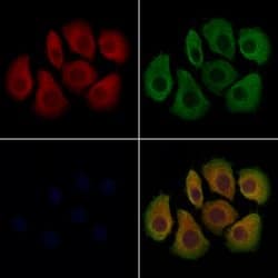 Invitrogen CCDC44 Polyclonal Antibody 100 &mu;L; Unconjugated:Antibodies,