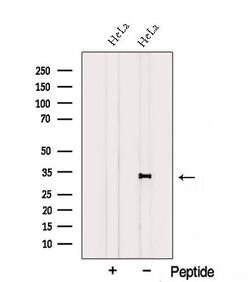 Invitrogen CCDC44 Polyclonal Antibody 100 &mu;L; Unconjugated:Antibodies,